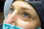 Permanent Makeup Eyeliner - Terraderma 2020