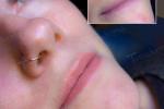 Nanaimo permanent lip blush - Terraderma 2024