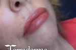 Lip blush tattoo - Nanaimo - Terraderma 2025