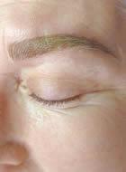 Nanaimo Eyebrow Microblading Procedure