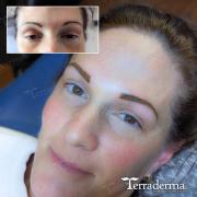 Permanent Brows Nanaimo BC - Terraderma March 2024