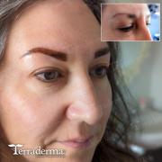Permanent brows - Feb 2024 - Terraderma Nanaimo
