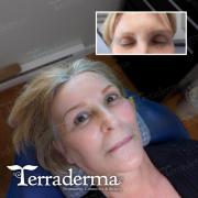 Permanent Powder Brow - Terraderma Nanaimo 2024