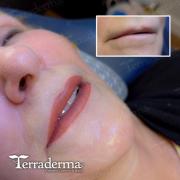 Tattooed Lip Liner - Nanaimo BC - Terraderma