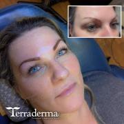 Powder Brow - Nanaimo BC - Terraderma Dec 2025