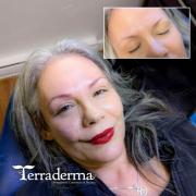 Nanaimo Microblading 2025 - Terraderma