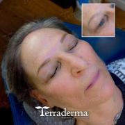Permanent Eyebrows - Nanaimo BC, Terraderma Permanent Makeup November 2025