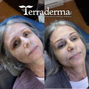 Ladysmith Nanaimo Cedar Permanent Brow Tattoo - Terraderma